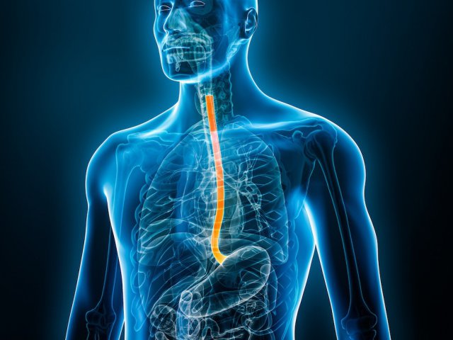 Yemek Borusu Kanseri